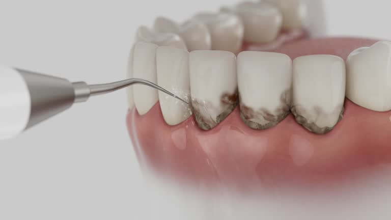 Trusted Wisdom Tooth Removal service in Rockwood, TN - Dentist Open Now